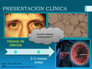 PRESENTACIÓN CLÍNICA

Anemia aplásica
Posthepatitis??

Historia de
ictericia

2-3 meses
antes

Blood. 2012;120(6):11851196.
British journal of haematology 2009;147:43-

 