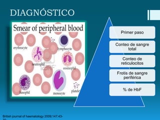 DIAGNÓSTICO
Primer paso
Conteo de sangre
total
Conteo de
reticulocitos
Frotis de sangre
periférica
% de HbF

British journal of haematology 2009;147:43-

 