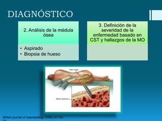 DIAGNÓSTICO
2. Análisis de la médula
ósea

• Aspirado
• Biopsia de hueso

British journal of haematology 2009;147:43-

3. Definición de la
severidad de la
enfermedad basado en
CST y hallazgos de la MO

 