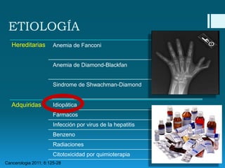 ETIOLOGÍA
Hereditarias

Anemia de Fanconi

Anemia de Diamond-Blackfan

Sindrome de Shwachman-Diamond

Adquiridas

Idiopática
Fármacos
Infección por virus de la hepatitis
Benzeno
Radiaciones
Citotoxicidad por quimioterapia

Cancerologia 2011; 6:125-28

 