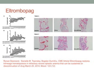 Eltrombopag
Ronan Desmond, Danielle M. Townsley, Bogdan Dumitriu, CME Article Eltrombopag restores
trilineage hematopoiesis in refractory severe aplastic anemia that can be sustained on
discontinuation of drug March 20, 2014; Blood: 123 (12)
 