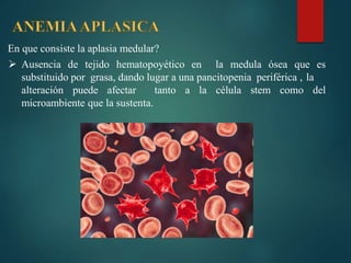 En que consiste la aplasia medular?
 Ausencia de tejido hematopoyético en la medula ósea que es
substituido por grasa, dando lugar a una pancitopenia periférica , la
alteración puede afectar tanto a la célula stem como del
microambiente que la sustenta.
 