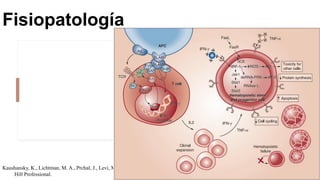 Kaushansky, K., Lichtman, M. A., Prchal, J., Levi, M. M., Press, O. W., Burns, L. J., & Caligiuri, M. (2015). Williams Hematology, 9E. McGraw
Hill Professional.
Fisiopatología
 