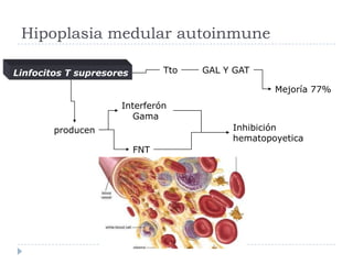 Hipoplasia medular autoinmune

Linfocitos T supresores         Tto   GAL Y GAT

                                                   Mejoría 77%
                     Interferón
                       Gama
        producen                           Inhibición
                                           hematopoyetica
                          FNT
 