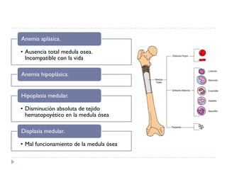 Anemia aplásica.

• Ausencia total medula osea.
  Incompatible con la vida

Anemia hipoplásica.


Hipoplasia medular.

• Disminución absoluta de tejido
  hematopoyético en la medula ósea

Displasia medular.

• Mal funcionamiento de la medula ósea
 
