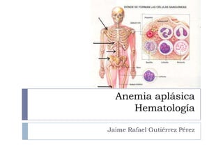 Anemia aplásica
     Hematología

Jaime Rafael Gutiérrez Pérez
 