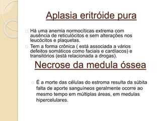Aplasia eritróide pura 
Há uma anemia normocíticas extrema com 
ausência de reticulócitos e sem alterações nos 
leucócitos e plaquetas. 
Tem a forma crônica ( está associada a vários 
defeitos somáticos como faciais e cardíacos) e 
transitórios (está relacionada a drogas). 
Necrose da medula óssea 
É a morte das células do estroma resulta da súbita 
falta de aporte sanguíneos geralmente ocorre ao 
mesmo tempo em múltiplas áreas, em medulas 
hipercelulares. 
 
