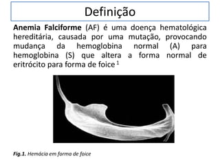 Definição
Anemia Falciforme (AF) é uma doença hematológica
hereditária, causada por uma mutação, provocando
mudança da hemoglobina normal (A) para
hemoglobina (S) que altera a forma normal de
eritrócito para forma de foice 1
Fig.1. Hemácia em forma de foice
 