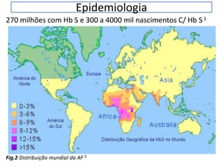 Epidemiologia
270 milhões com Hb S e 300 a 4000 mil nascimentos C/ Hb S3
Fig.2 Distribuição mundial da AF 2
 