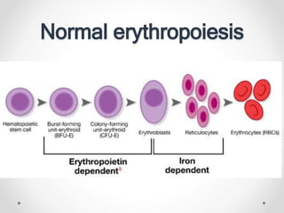 Normal erythropoiesis
 