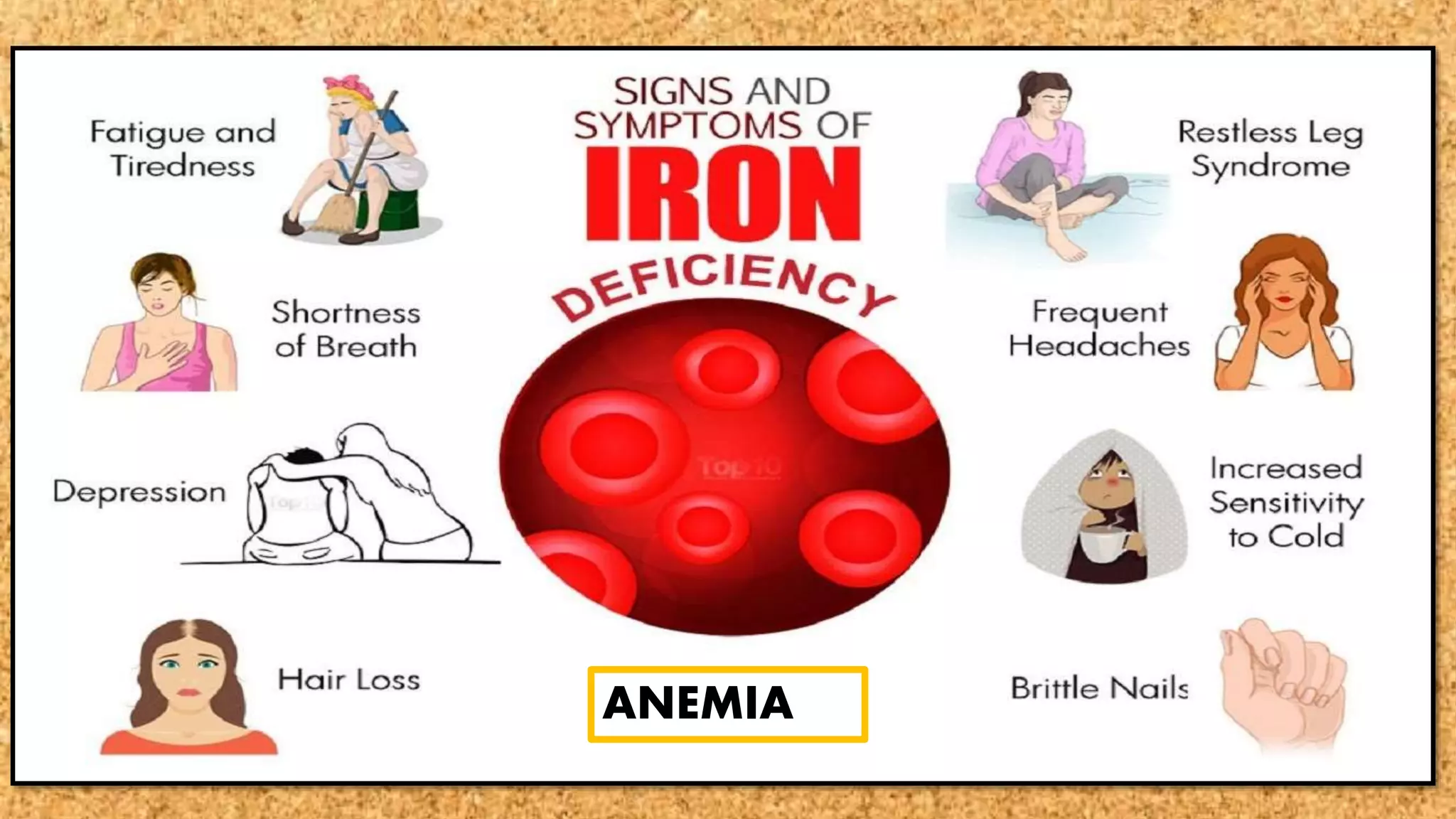 ANEMIA