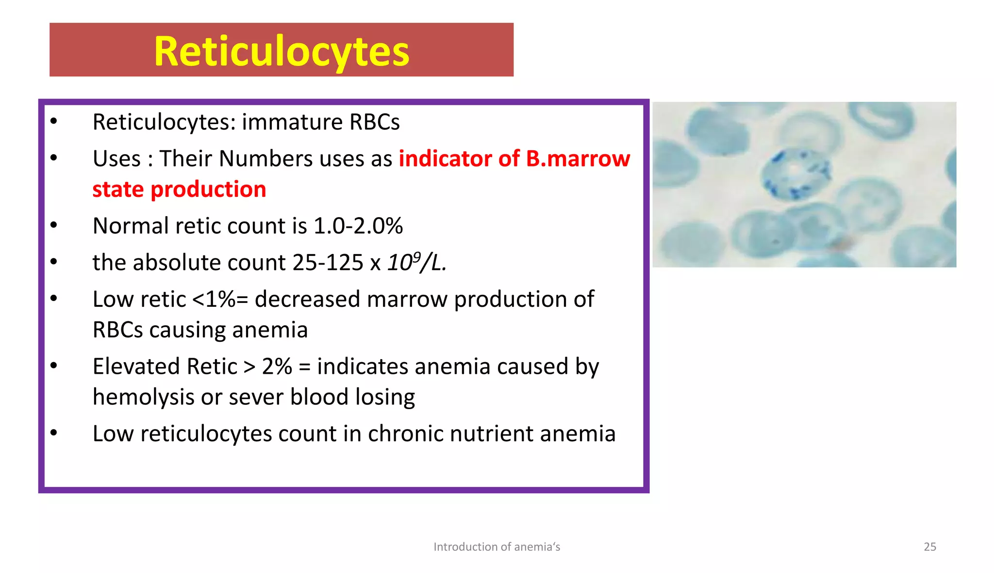 Reticulocytes
• Reticulocytes: immature RBCs
• Uses : Their Numbers uses as indicator of B.marrow
state production
• Normal retic count is 1.0-2.0%
• the absolute count 25-125 x 109/L.
• Low retic <1%= decreased marrow production of
RBCs causing anemia
• Elevated Retic > 2% = indicates anemia caused by
hemolysis or sever blood losing
• Low reticulocytes count in chronic nutrient anemia
25
Introduction of anemia‘s
 