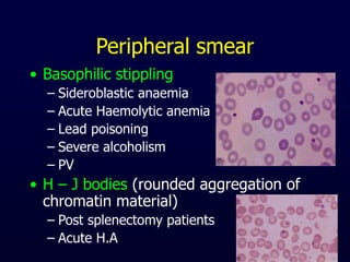 Peripheral smear
• Basophilic stippling
– Sideroblastic anaemia
– Acute Haemolytic anemia
– Lead poisoning
– Severe alcoholism
– PV
• H – J bodies (rounded aggregation of
chromatin material)
– Post splenectomy patients
– Acute H.A
 