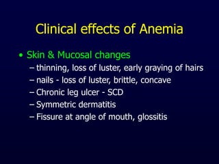 Clinical effects of Anemia
• Skin & Mucosal changes
– thinning, loss of luster, early graying of hairs
– nails - loss of luster, brittle, concave
– Chronic leg ulcer - SCD
– Symmetric dermatitis
– Fissure at angle of mouth, glossitis
 