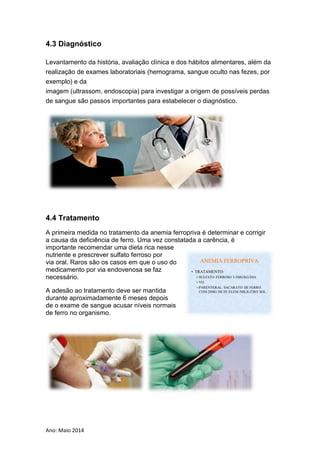 Ano: Maio 2014
4.3 Diagnóstico
Levantamento da história, avaliação clínica e dos hábitos alimentares, além da
realização de exames laboratoriais (hemograma, sangue oculto nas fezes, por
exemplo) e da
imagem (ultrassom, endoscopia) para investigar a origem de possíveis perdas
de sangue são passos importantes para estabelecer o diagnóstico.
4.4 Tratamento
A primeira medida no tratamento da anemia ferropriva é determinar e corrigir
a causa da deficiência de ferro. Uma vez constatada a carência, é
importante recomendar uma dieta rica nesse
nutriente e prescrever sulfato ferroso por
via oral. Raros são os casos em que o uso do
medicamento por via endovenosa se faz
necessário.
A adesão ao tratamento deve ser mantida
durante aproximadamente 6 meses depois
de o exame de sangue acusar níveis normais
de ferro no organismo.
 
