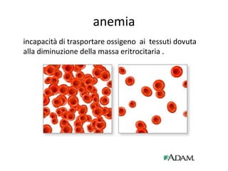 anemia
incapacità di trasportare ossigeno ai tessuti dovuta
alla diminuzione della massa eritrocitaria .

 