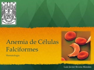 Anemia de Células
Falciformes
Hematología



                    Luis Javier Rivera Morales
 