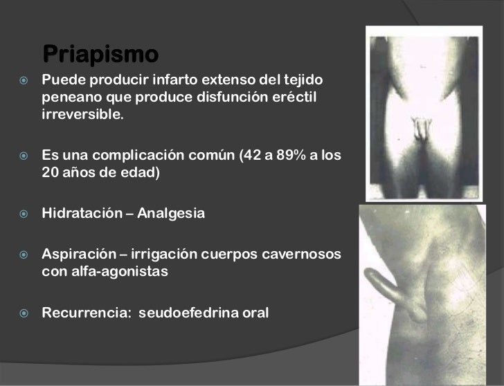 Ultrasonoro sonografiya sheynogo del departamento