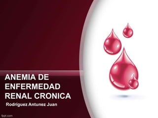 ANEMIA DE
ENFERMEDAD
RENAL CRONICA
Rodríguez Antunez Juan

 