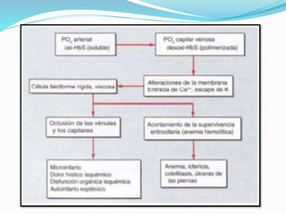 Anemia drepanocítica | PPTX