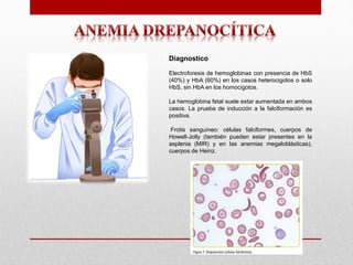 Anemia Drepanocítica Presentacion, que es | PDF