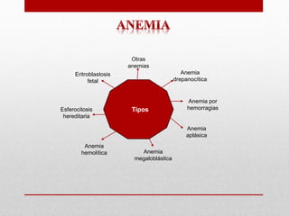 Anemia Drepanocítica Presentacion, que es | PDF