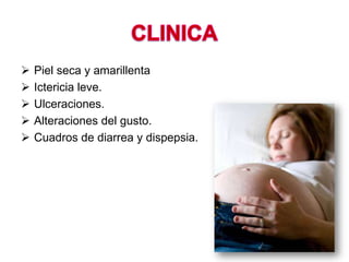  Piel seca y amarillenta
 Ictericia leve.
 Ulceraciones.
 Alteraciones del gusto.
 Cuadros de diarrea y dispepsia.
 