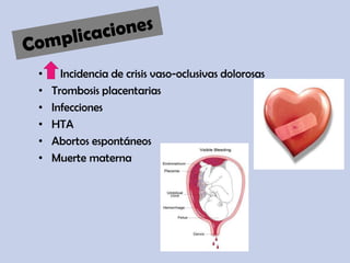 • Incidencia de crisis vaso-oclusivas dolorosas
• Trombosis placentarias
• Infecciones
• HTA
• Abortos espontáneos
• Muerte materna
 