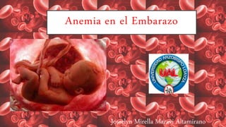Anemia en el Embarazo
Josselyn Mirella Maravi Altamirano
 