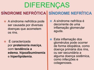  A síndrome nefrótica pode
ser causada por diversas
doenças que acometem
os rins.
 É caracterizada
por proteinúria maciça,
com tendência a
edema, hipoalbuminemia
e hiperlipidemia.
 A síndrome nefrítica é
decorrente de uma
inflamação glomerular
aguda.
 Esta inflamação dos
glomérulos pode ocorrer
de forma idiopática, como
doença primária dos rins,
ou ser secundária a
alguma doença sistêmica,
como infecções e
colagenoses.
 