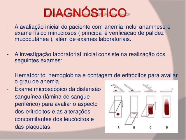 Exames para anemia