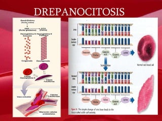 DREPANOCITOSIS 