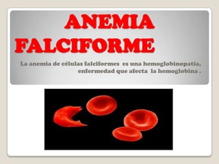ANEMIA  FALCIFORME  La anemia de células falciformes  es una hemoglobinopatía, enfermedad que afecta  la hemoglobina .  