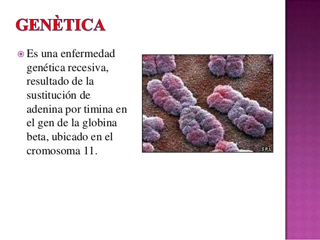 Pequeño esto el pecho después de la operación