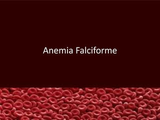 Anemia Falciforme
 