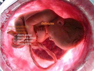 Definições
• Aborto espontâneo:
• Aborto induzido:
• Aborto terapêutico
        • Aborto eletivo:
        • Aborto sub clínico:
        • Aborto precoce:
        • Aborto tardio:
 