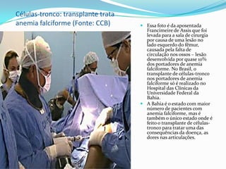 Células-tronco: transplante trata
anemia falciforme (Fonte: CCB)       Essa foto é da aposentada
                                      Francimeire de Assis que foi
                                      levada para a sala de cirurgia
                                      por causa de uma lesão no
                                      lado esquerdo do fêmur,
                                      causada pela falta de
                                      circulação nos ossos – lesão
                                      desenvolvida por quase 10%
                                      dos portadores de anemia
                                      falciforme. No Brasil, o
                                      transplante de células-tronco
                                      nos portadores de anemia
                                      falciforme só é realizado no
                                      Hospital das Clínicas da
                                      Universidade Federal da
                                      Bahia.
                                     A Bahia é o estado com maior
                                      número de pacientes com
                                      anemia falciforme, mas é
                                      também o único estado onde é
                                      feito o transplante de células-
                                      tronco para tratar uma das
                                      consequências da doença, as
                                      dores nas articulações.
 
