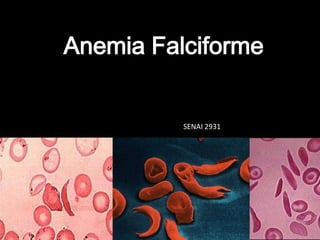 Anemia Falciforme
SENAI 2931
 