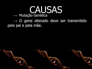 CAUSAS→ Mutação Genética
→ O gene alterado deve ser transmitido
pelo pai e pela mãe.
 