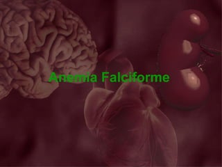 Anemia Falciforme
 