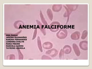 ANA PAULA
JANINA GUIMARÃES
KARINA FERNANDES
LORENNA EVELYN
MARA FREIRE
MARCELA CARMO
TAYRINE LUDMILA
ANEMIA FALCIFORME
 