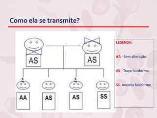 Como ela se transmite?
LEGENDA:
AA - Sem alteração.
AS- Traço falciforme.
SS- Anemia falciforme.
 