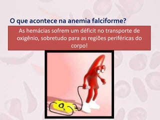 O que acontece na anemia falciforme?
As hemácias sofrem um déficit no transporte de
oxigênio, sobretudo para as regiões periféricas do
corpo!
 