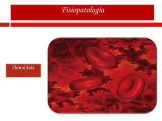 Hemólisis
Fisiopatología
 