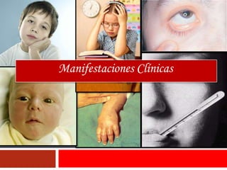 Manifestaciones Clínicas
 