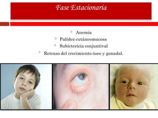 Anemia
Palidez cutáneomucosa
Subictericia conjuntival
Retraso del crecimiento óseo y gonadal.
Fase Estacionaria
 