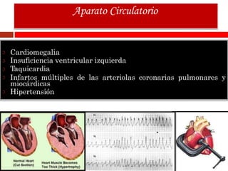 Cardiomegalia
Insuficiencia ventricular izquierda
Taquicardia
Infartos múltiples de las arteriolas coronarias pulmonares y
miocárdicas
Hipertensión
Aparato Circulatorio
 