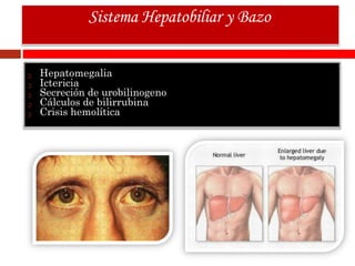 Hepatomegalia
Ictericia
Secreción de urobilinogeno
Cálculos de bilirrubina
Crisis hemolítica
Sistema Hepatobiliar y Bazo
 