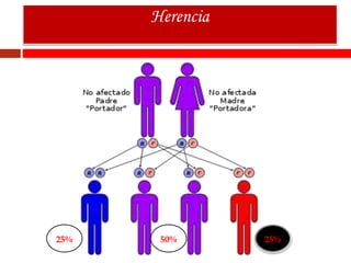 Herencia
25% 50% 25%
 