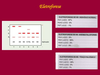 Eletroforese
 
